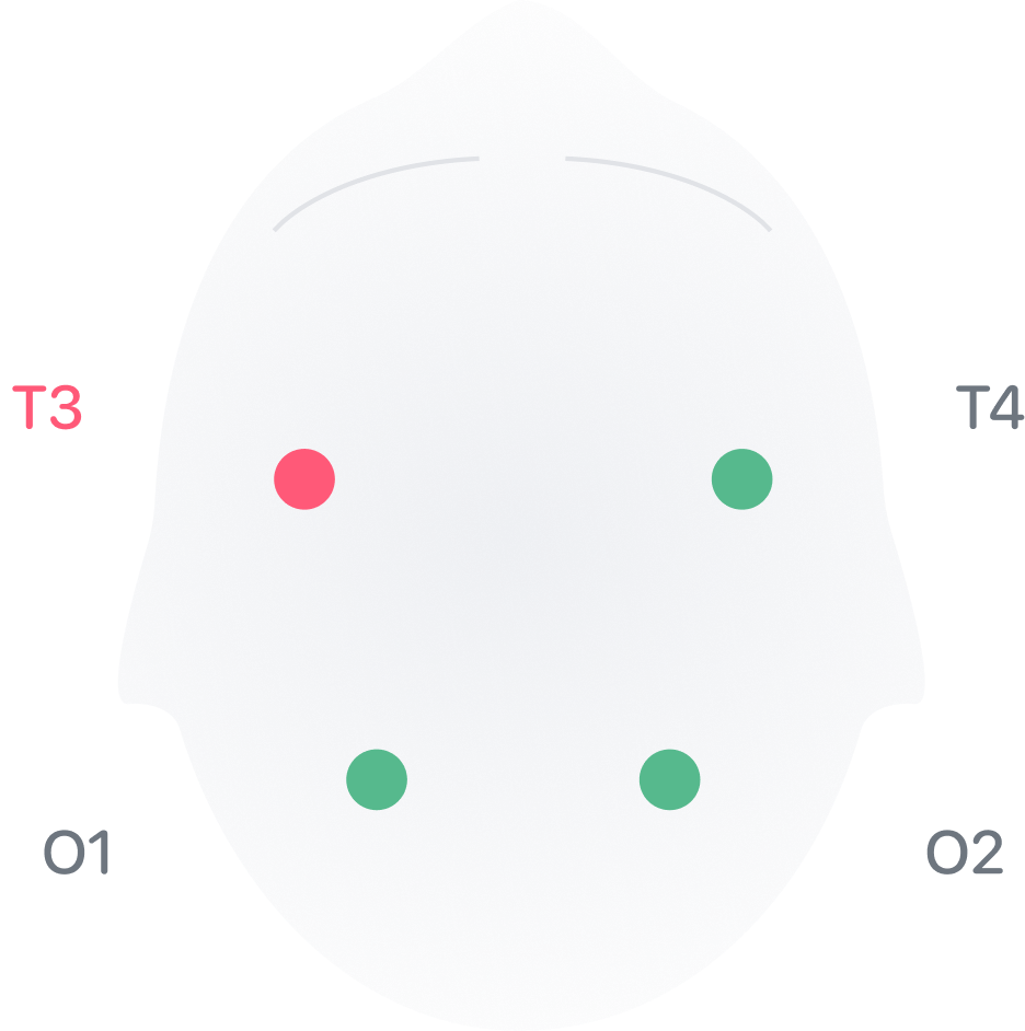 Sensor placement scheme